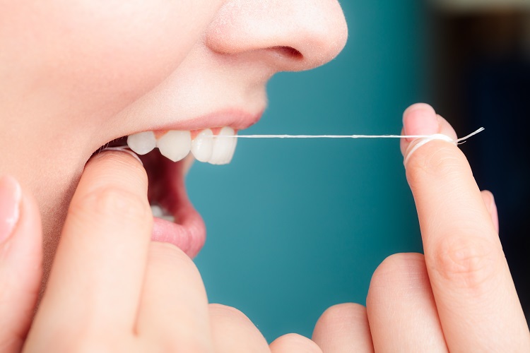 dùng chỉ nha khoa để loại bỏ mảng bám