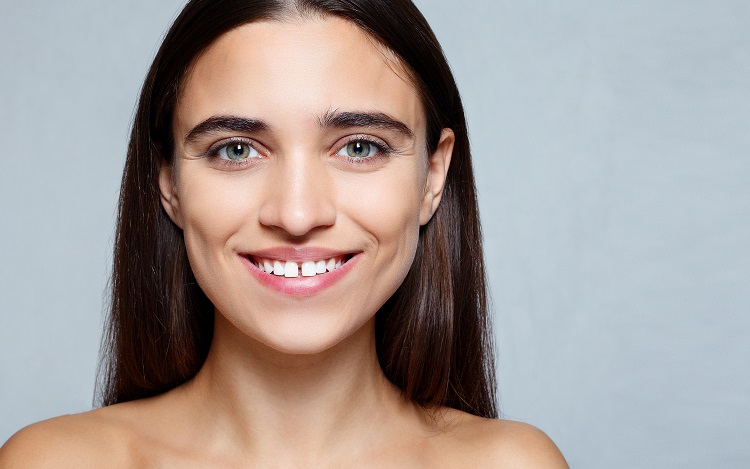 gap between teeth