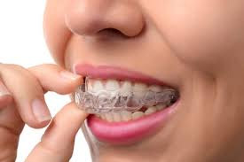 Clear retainer