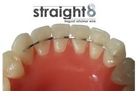 Wire retainer