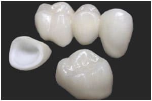 mão veneer toàn sứ