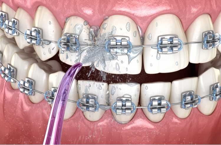 sử dụng máy tăm nước