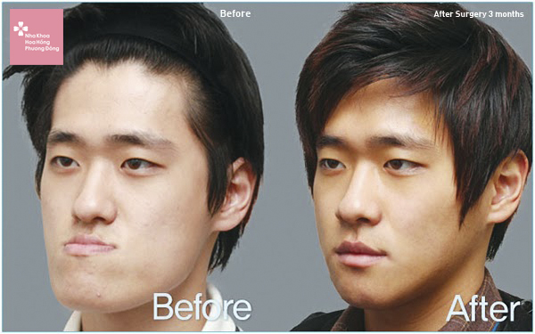 Where is the most prestigious clinic for underbite surgery?