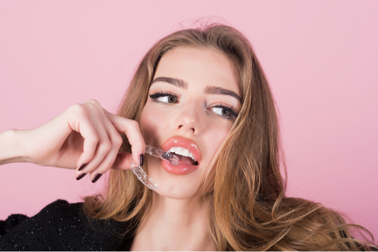 What are the advantages of invisalign braces?