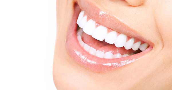Bọc răng sứ là gì? Có mấy loại? Chi phí bao nhiêu?