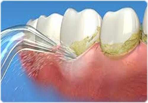 sử dụng bàn chải nước