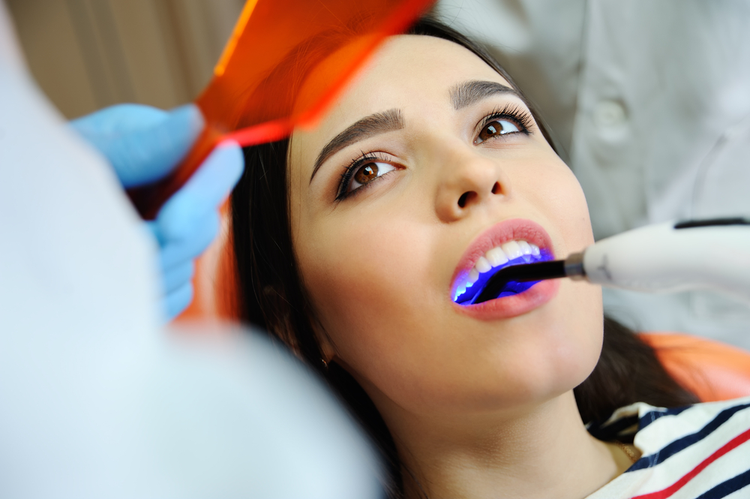 Tooth fillings and everything you need to know